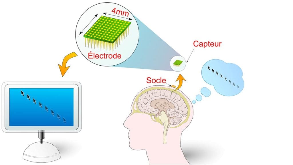 Brain-Computer Interface Innovations