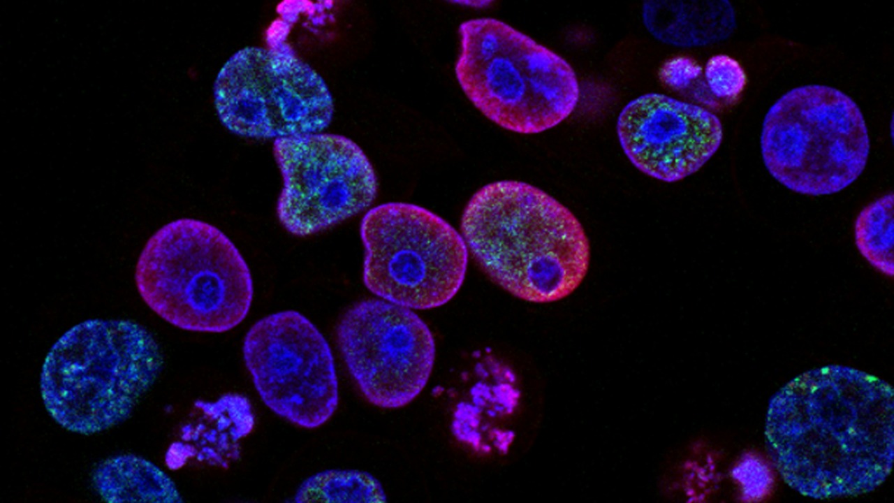 Image Credit: purple cells — National Cancer Institute