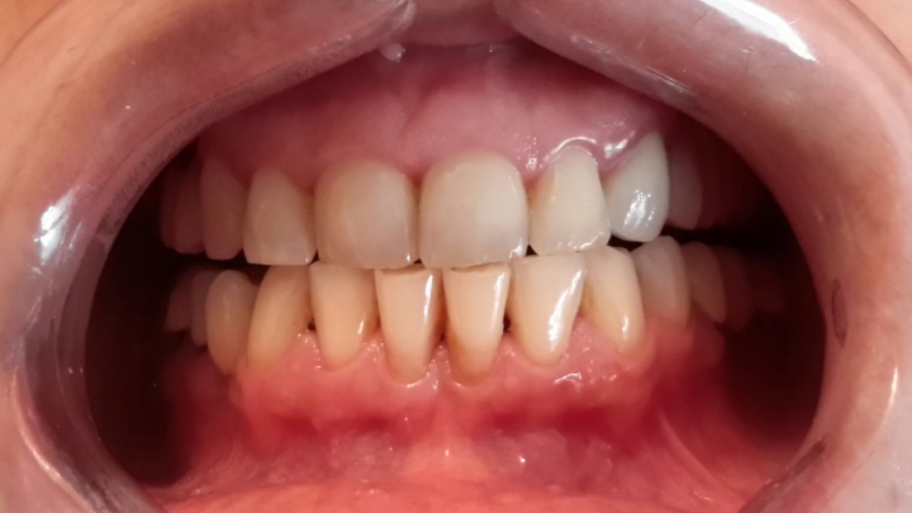 Image Credit: Geaninamiu - CC BY-SA 4.0/Wiki Commons