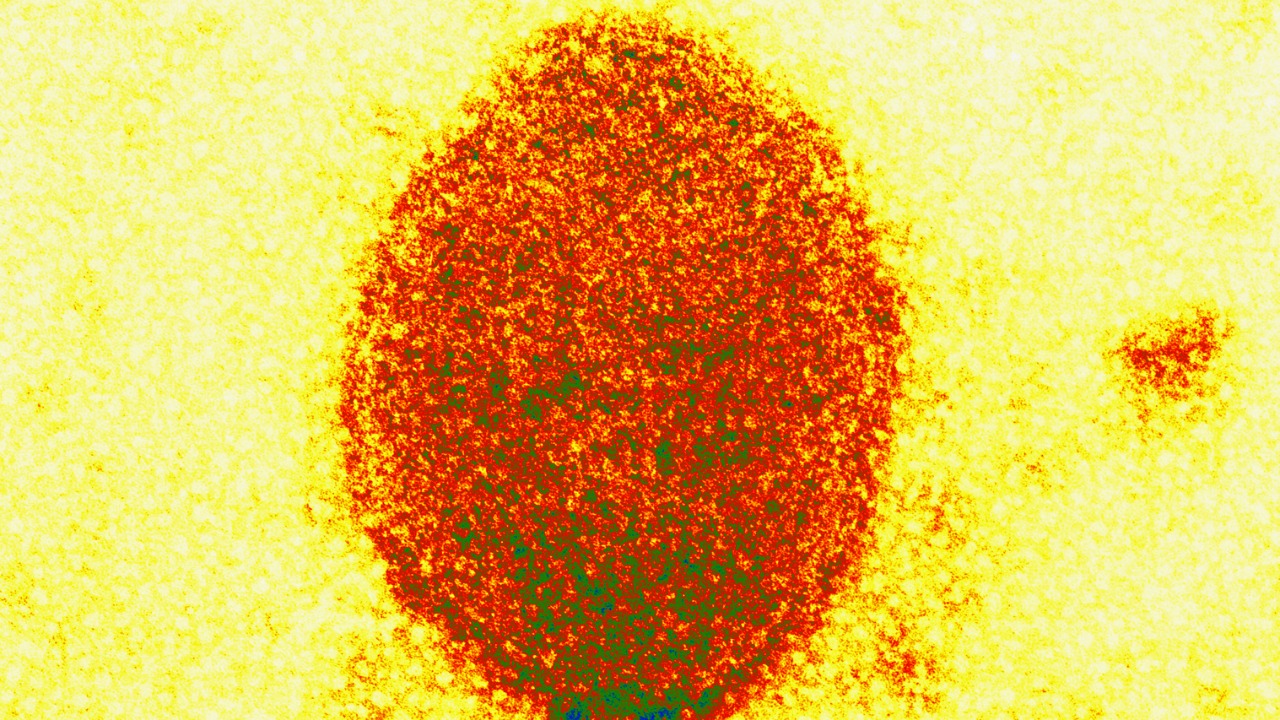 Image Credit: Electron Microscopy Unit AAHL, CSIRO - CC BY 3.0/Wiki Commons