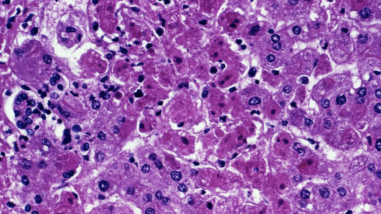 Image Credit: Photo Credit:
Content Providers(s): CDC/ Dr. J. Lyle Conrad - Public domain/Wiki Commons