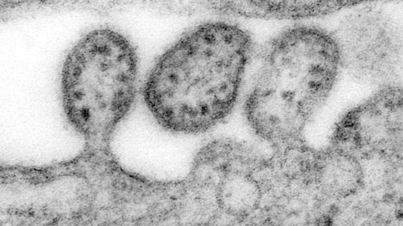 Image Credit: Content Providers(s): CDC/ C. S. Goldsmith, D. Auperin
Photo Credit: C. S. Goldsmith
Copyright Restrictions: None - This image is in the public domain and thus free of any copyright restrictions. As a matter of courtesy we request that the content provider be credited and notified in any public or private usage of this image. - Public domain/Wiki Commons