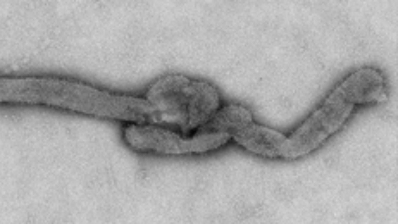 Image Credit: Olga I. Kosoy, Amy J. Lambert, Dana J. Hawkinson, Daniel M. Pastula, Cynthia S. Goldsmith, D. Charles Hunt, and J. Erin Staples - Public domain/Wiki Commons