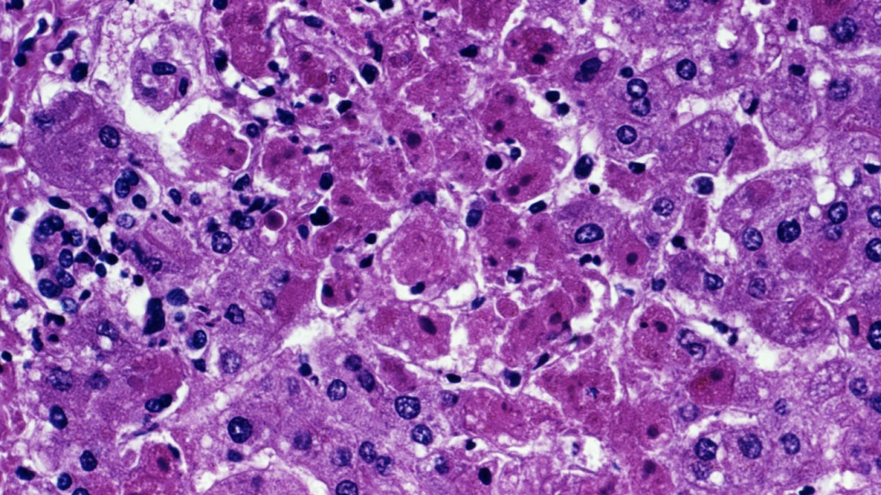 Image Credit: Photo Credit:
Content Providers(s): CDC/ Dr. J. Lyle Conrad – Public domain/Wiki Commons