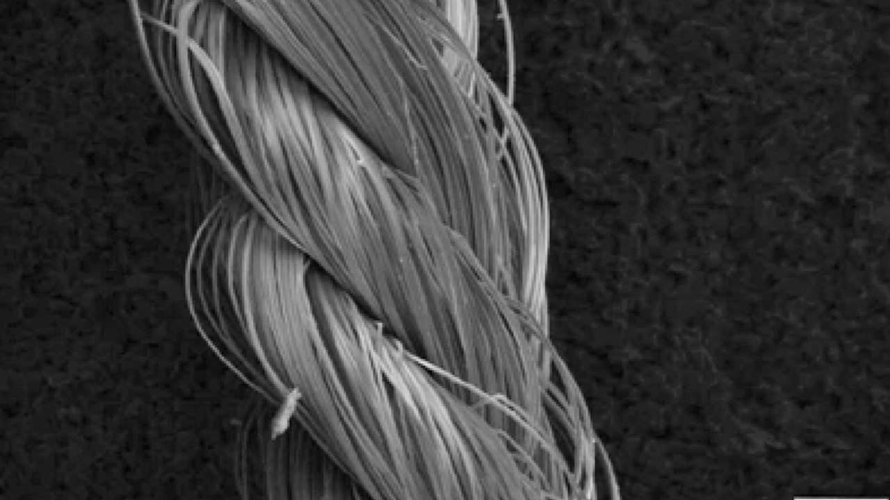 Image Credit: Hennecke, K., Redeker, J., Kuhbier, J. W., Strauss, S., Allmeling, C., Kasper, C., Reimers, K., & Vogt, P. M. - CC BY 4.0/Wiki Commons