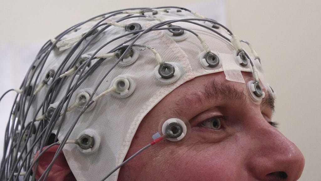 1280px-EEG_Recording_Cap