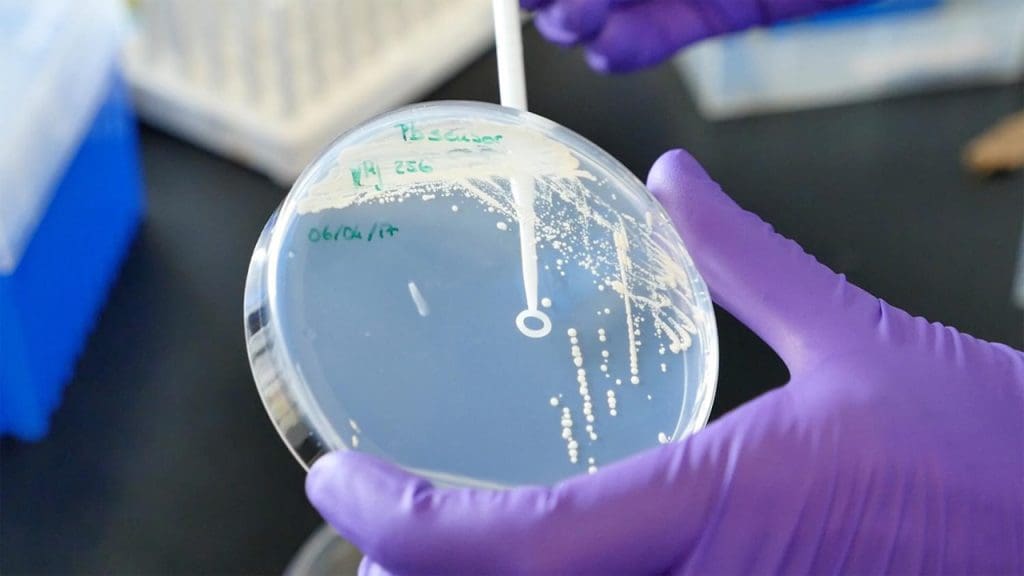 Researchers develop yeast-based tool for worldwide pathogen detection