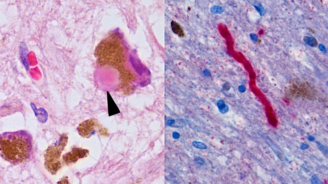Image Credit: Werner CJ., Heyny-von Haussen R., Mall G., Wolf S. Proteome analysis of human substantia nigra in Parkinson's disease.. Proteome Sci. 6, 8. 2008. doi:10.1186/1477-5956-6-8. PMID 18275612. - CC BY 2.0/Wiki Commons