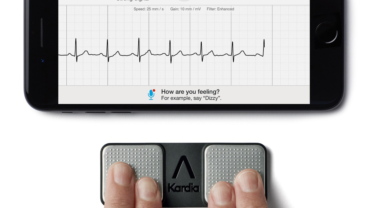 Image Credit: AliveCor Inc. - CC BY-SA 4.0/Wiki Commons