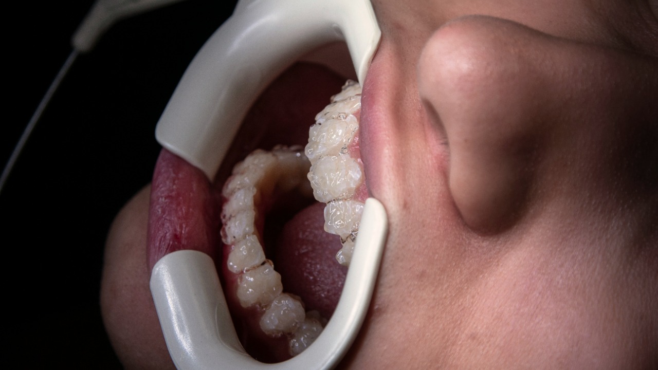 dentistozkanguner/Unsplash