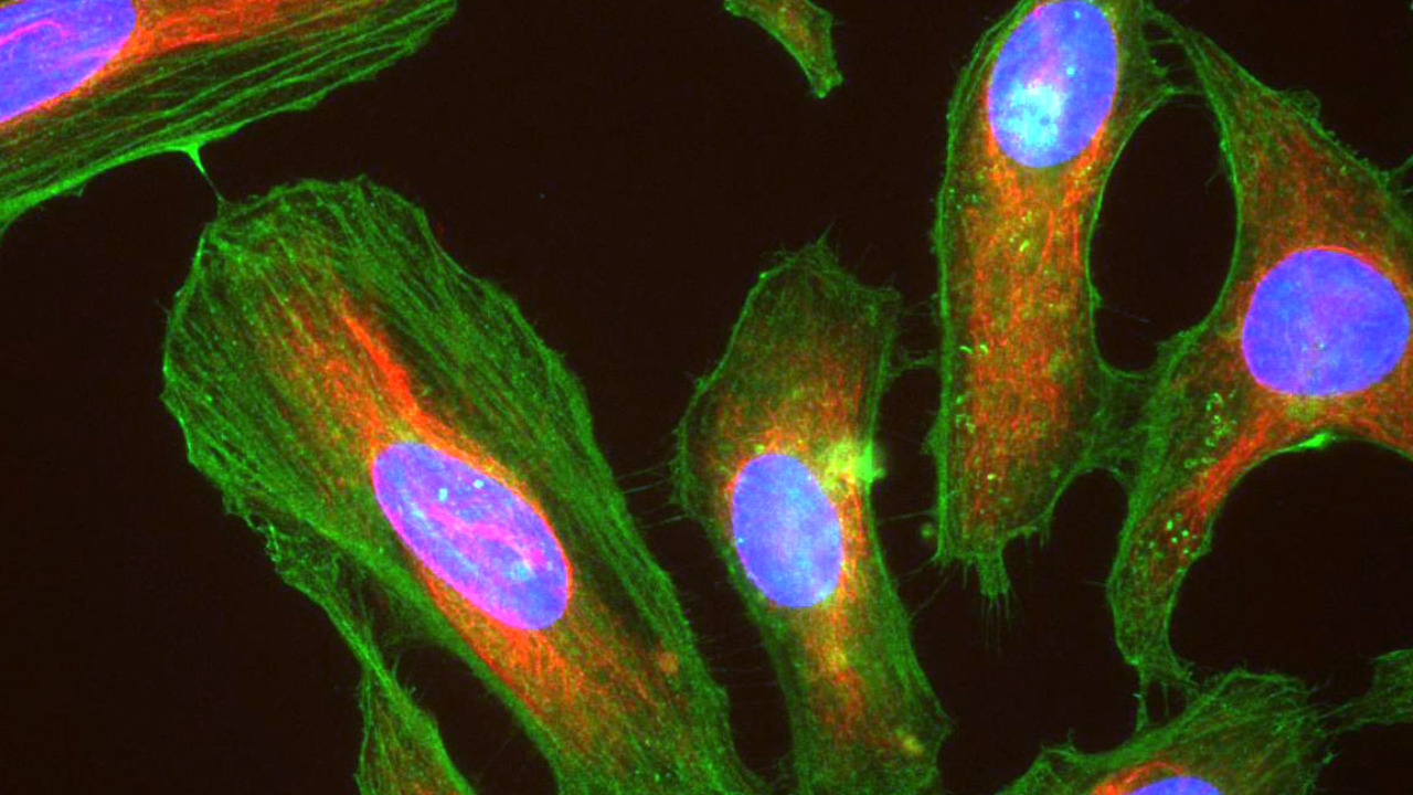 Image Credit: GerryShaw - CC BY-SA 3.0/Wiki Commons