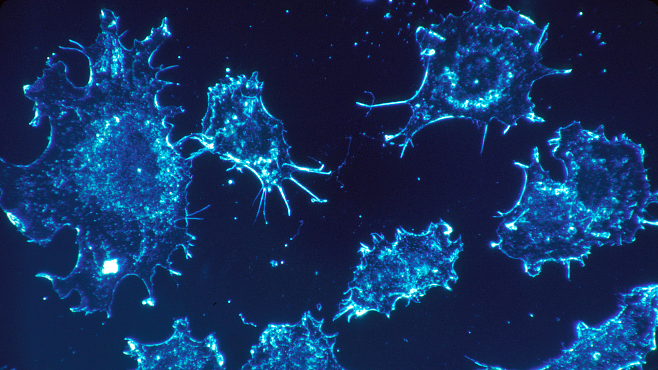 Image Credit: Dr. Cecil Fox (Photographer) - Public domain/Wiki Commons