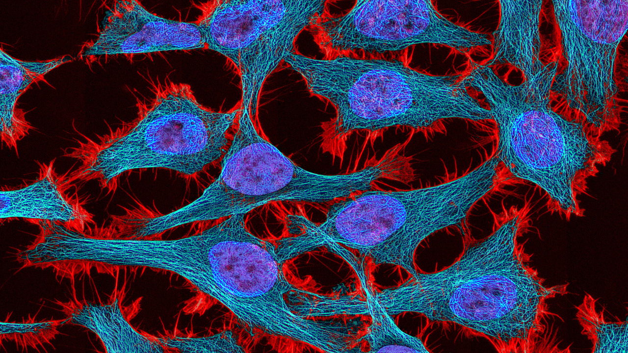 Image Credit: National Institutes of Health (NIH) - Public domain/Wiki Commons