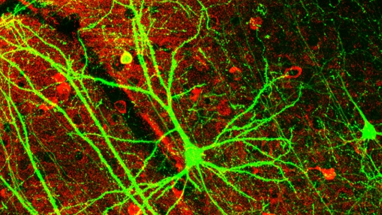 Image Credit: Wei-Chung Allen Lee, Hayden Huang, Guoping Feng, Joshua R. Sanes, Emery N. Brown, Peter T. So, Elly Nedivi - CC BY 2.5/Wiki Commons