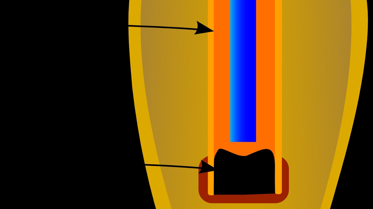 Image Credit: Chatsam - CC BY-SA 3.0/Wiki Commons