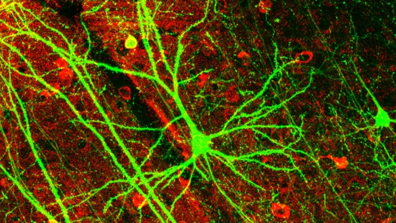Image Credit: Wei-Chung Allen Lee, Hayden Huang, Guoping Feng, Joshua R. Sanes, Emery N. Brown, Peter T. So, Elly Nedivi - CC BY 2.5/Wiki Commons