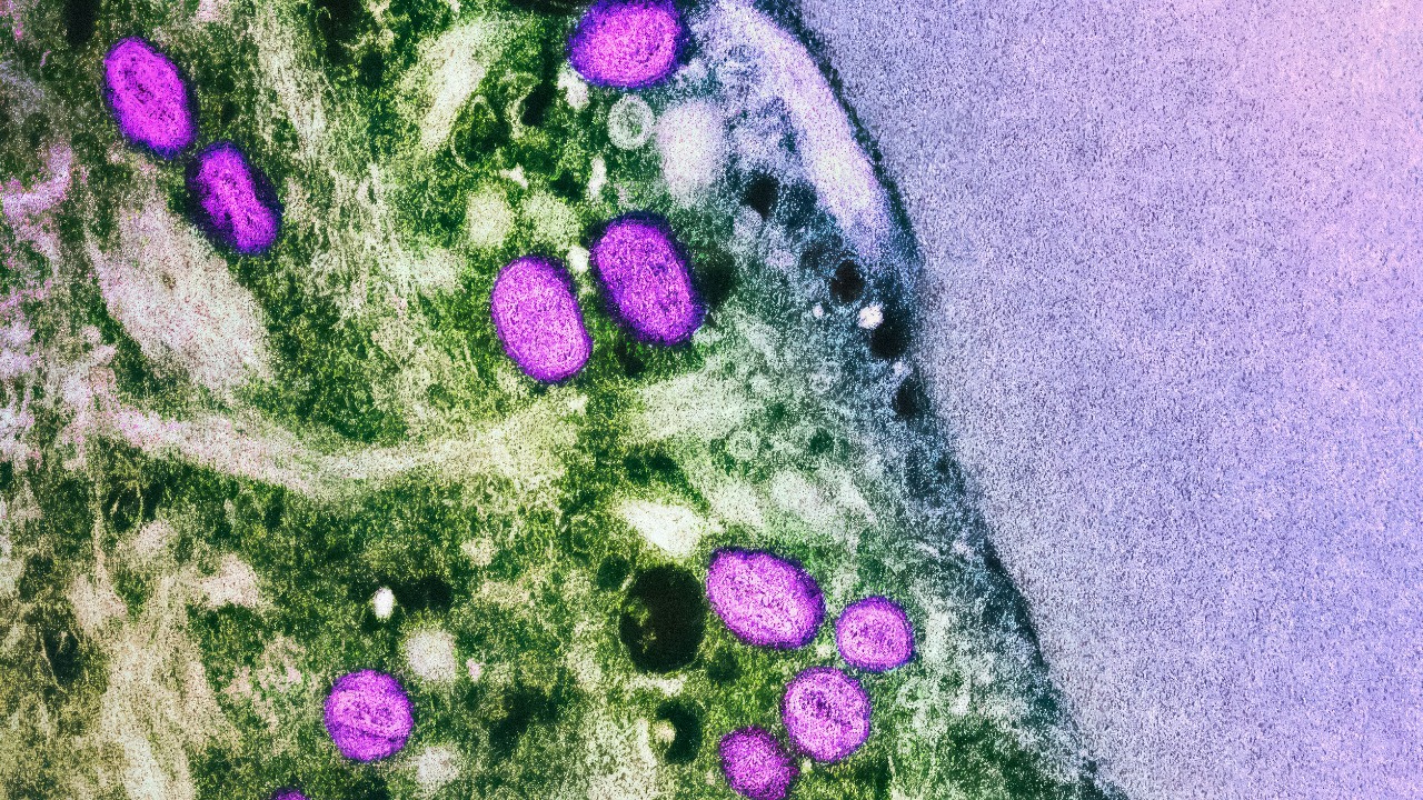 niaid/Unsplash