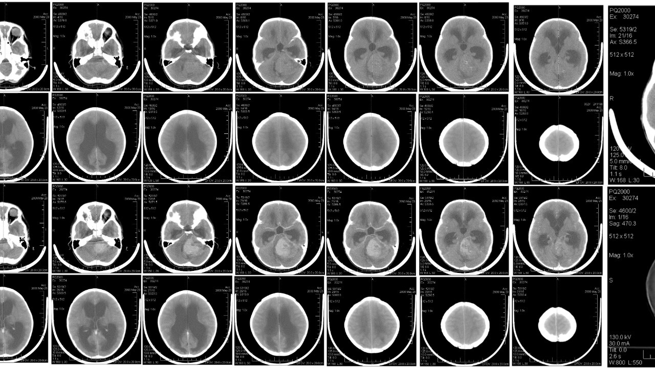 Image Credit: unknown - Public domain/Wiki Commons