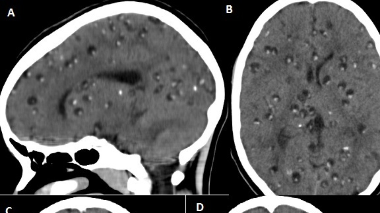 Image Credit: Innocent Lule Segamwenge - CC BY 4.0/Wiki Commons