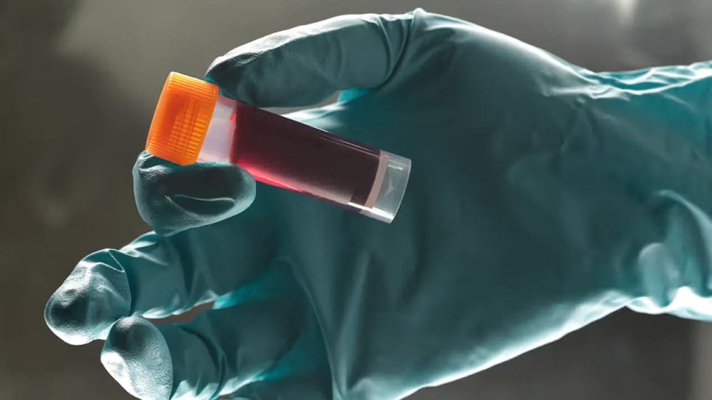 glove-holding-blood-sample-for-testing-1280x720-header