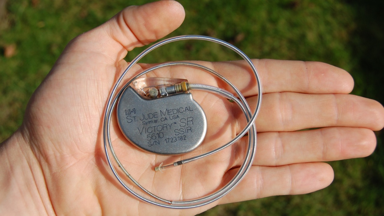 Image Credit: Steven Fruitsmaak - CC BY 3.0/Wiki Commons