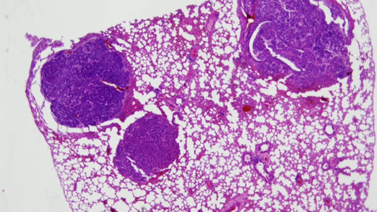 Image Credit: National Institute of Standards and Technology - Public domain/Wiki Commons