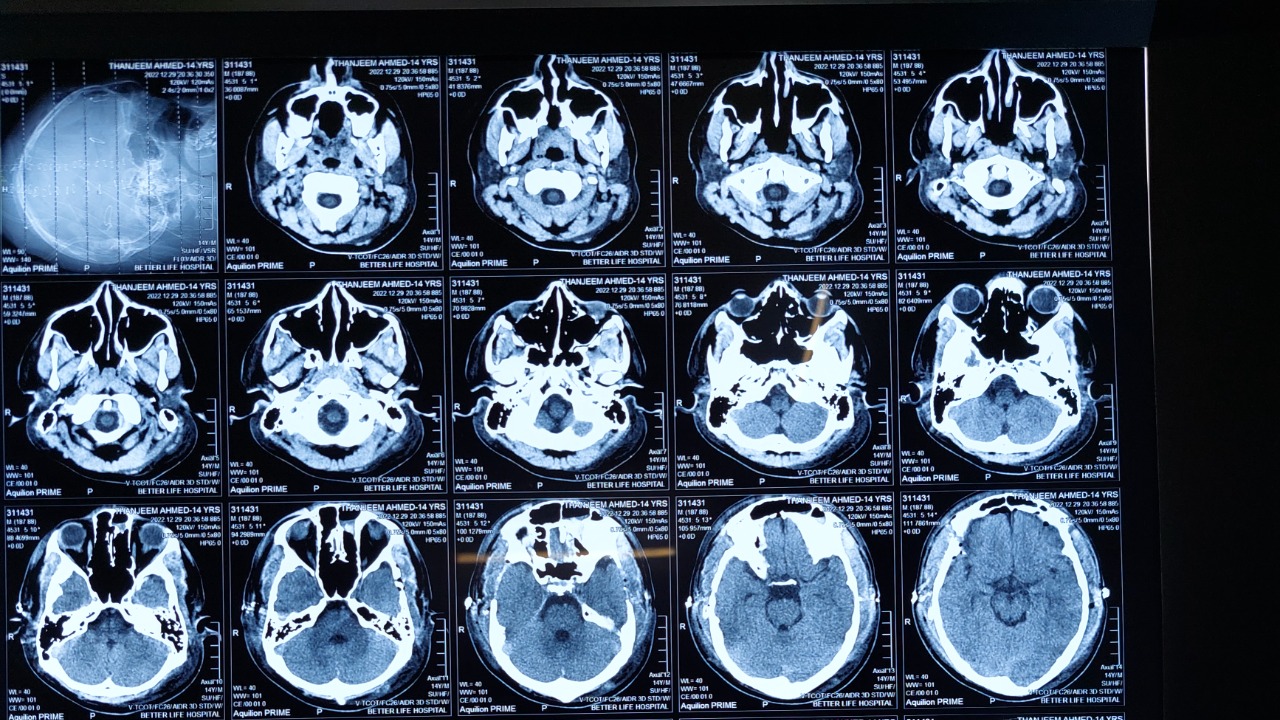 Image Credit: Tanfarid - CC BY-SA 4.0/Wiki Commons