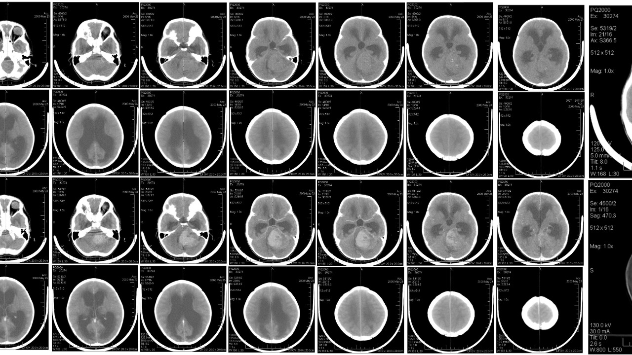 Image Credit: unknown - Public domain/Wiki Commons