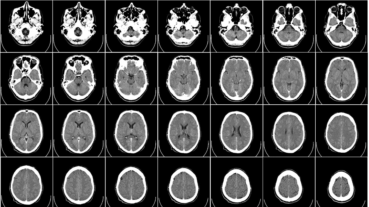 Image Credit: Department of Radiology, Uppsala University Hospital. Uploaded by Mikael Häggström. - CC0/Wiki Commons