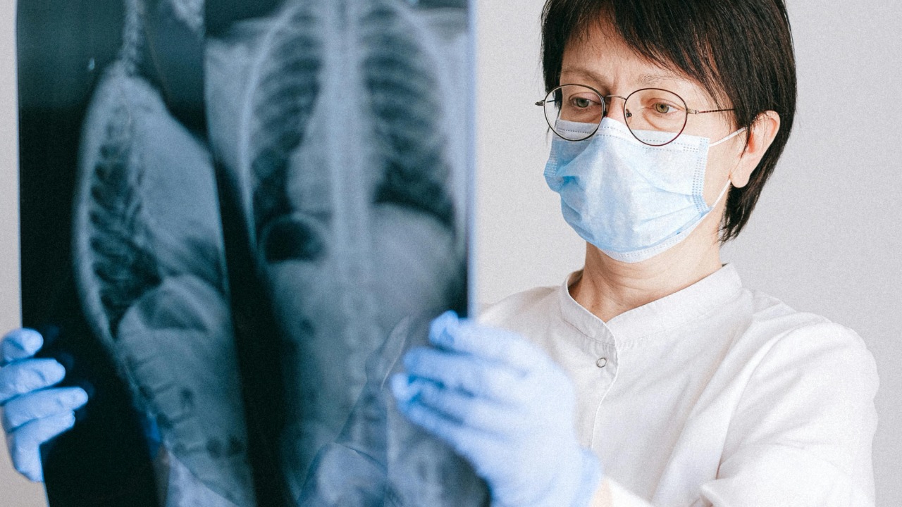 Crispr reveals a new way to defeat resistant lung cancer