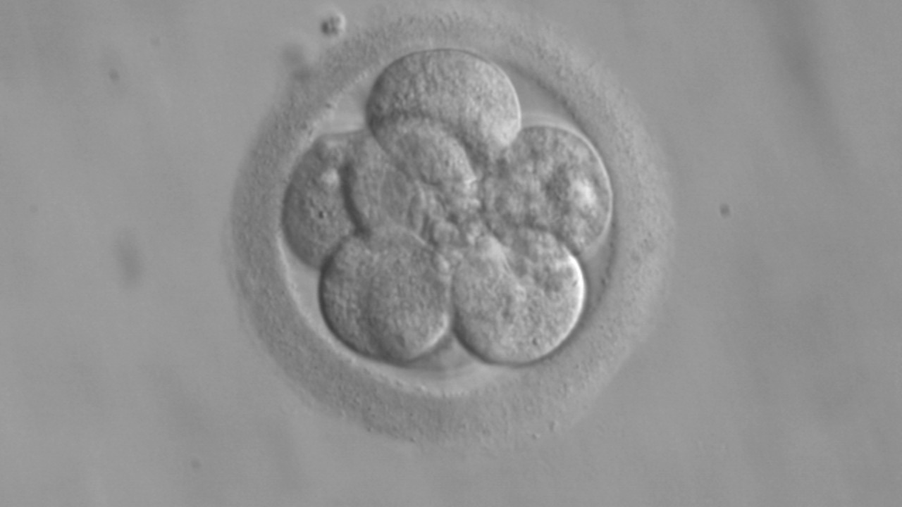 Image Credit: ekem, Courtesy: RWJMS IVF Program - Public domain/Wiki Commons