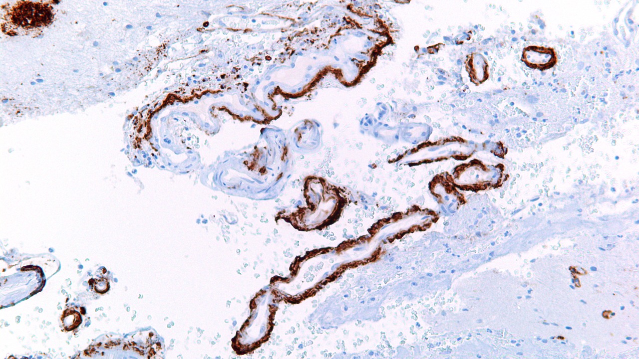 Image Credit: Nephron - CC BY-SA 3.0/Wiki Commons