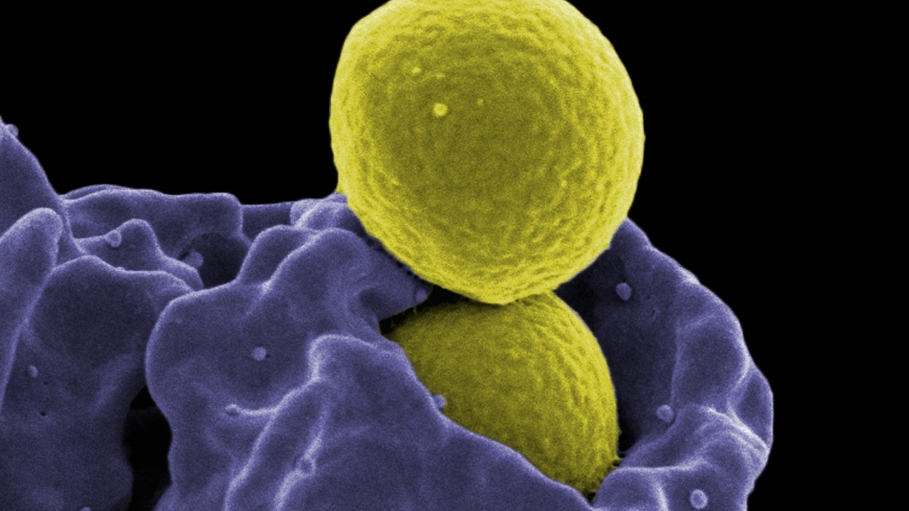 Image Credit: National Institutes of Health (NIH) - Public domain/Wiki Commons