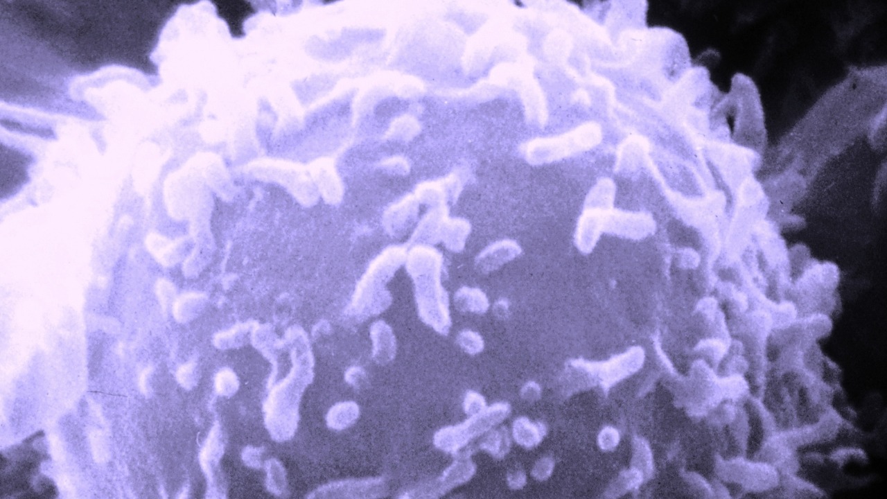 Image Credit: Unknown photographer/artist (False color modifications made by myself--DO11.10) - Public domain/Wiki Commons