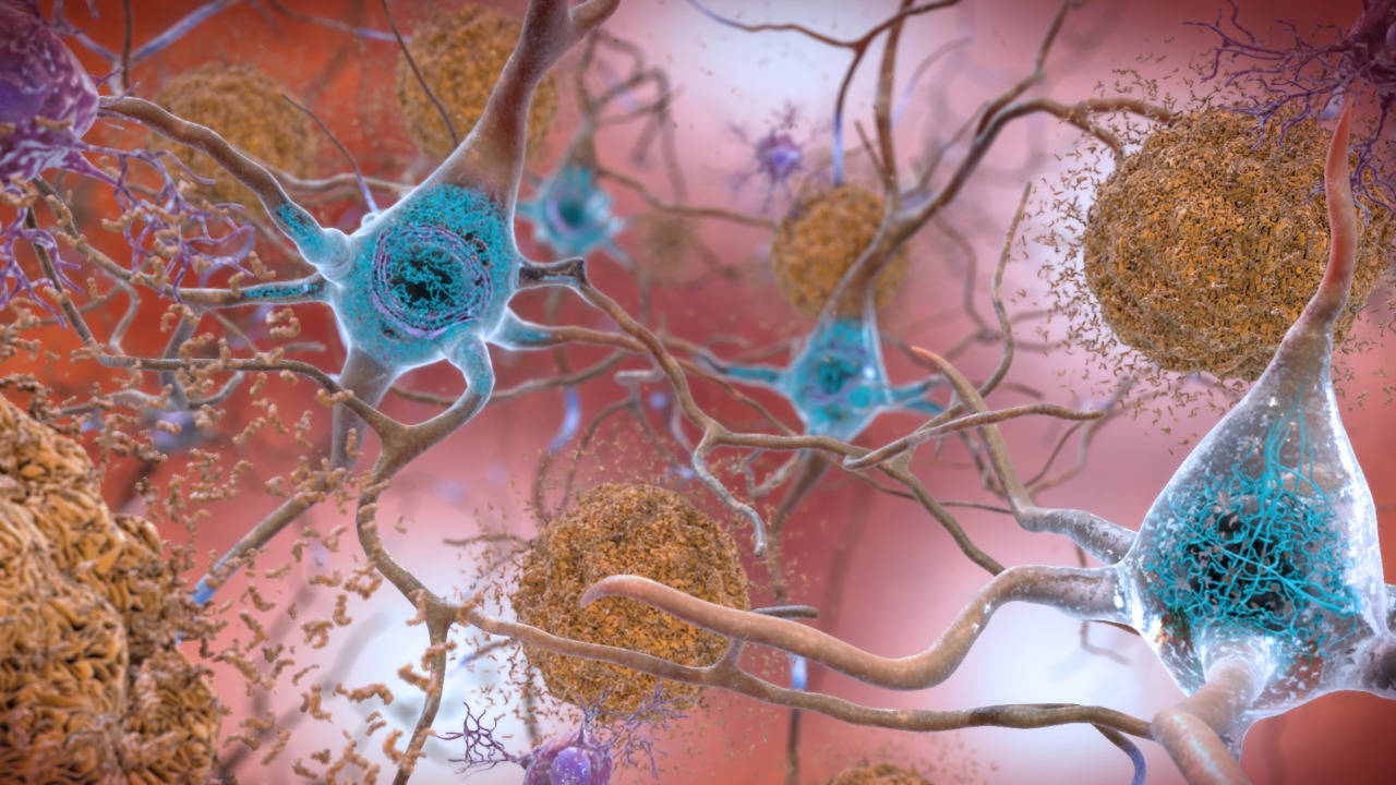 Image Credit: NIH Image Gallery from Bethesda, Maryland, USA - Public domain/Wiki Commons