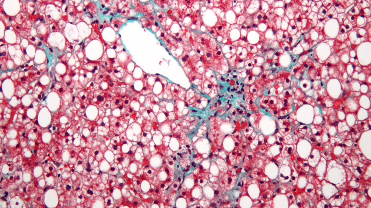 Image Credit: Nephron - CC BY-SA 3.0/Wiki Commons