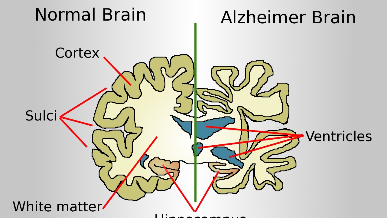 Image Credit: Garrondo - Public domain/Wiki Commons