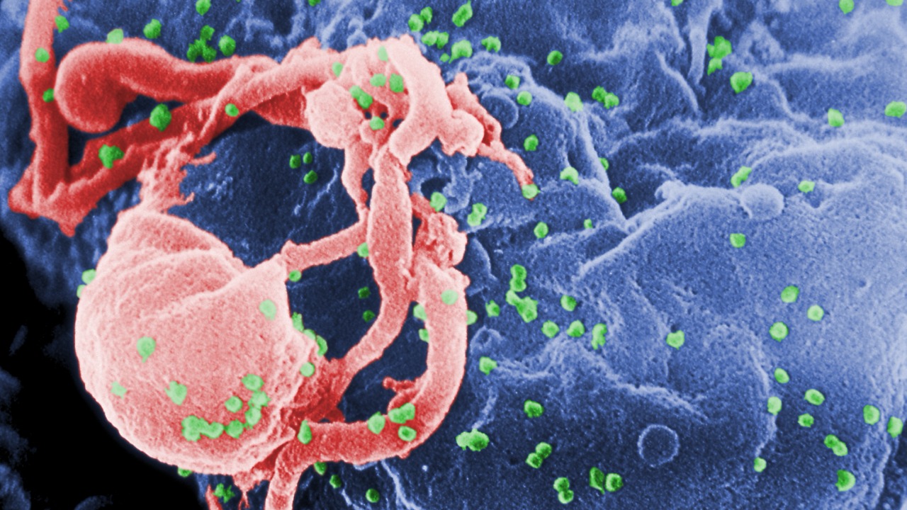 Image Credit: Photo Credit: C. Goldsmith Content Providers: CDC/ C. Goldsmith, P. Feorino, E. L. Palmer, W. R. McManus - Public domain/Wiki Commons