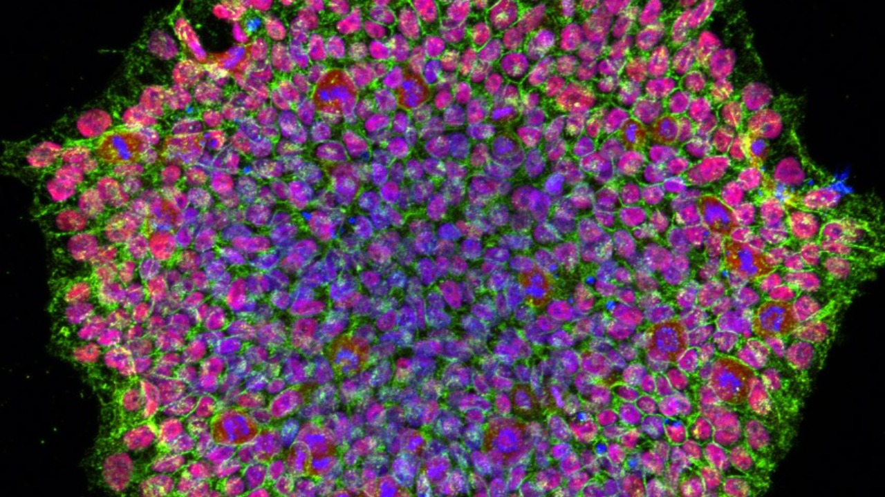 Image Credit: NIH Image Gallery from Bethesda, Maryland, USA - Public domain/Wiki Commons