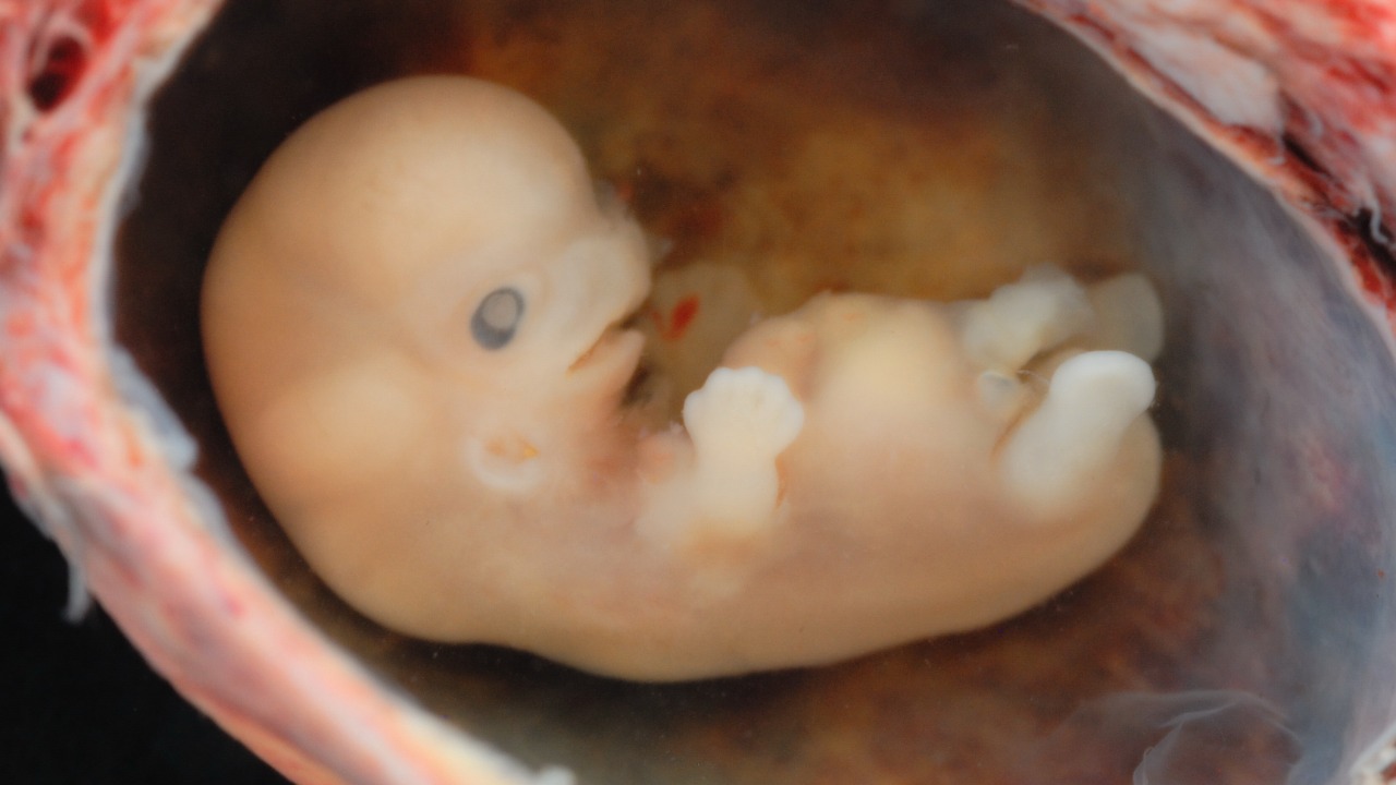 Image Credit: lunar caustic - CC BY 2.0/Wiki Commons