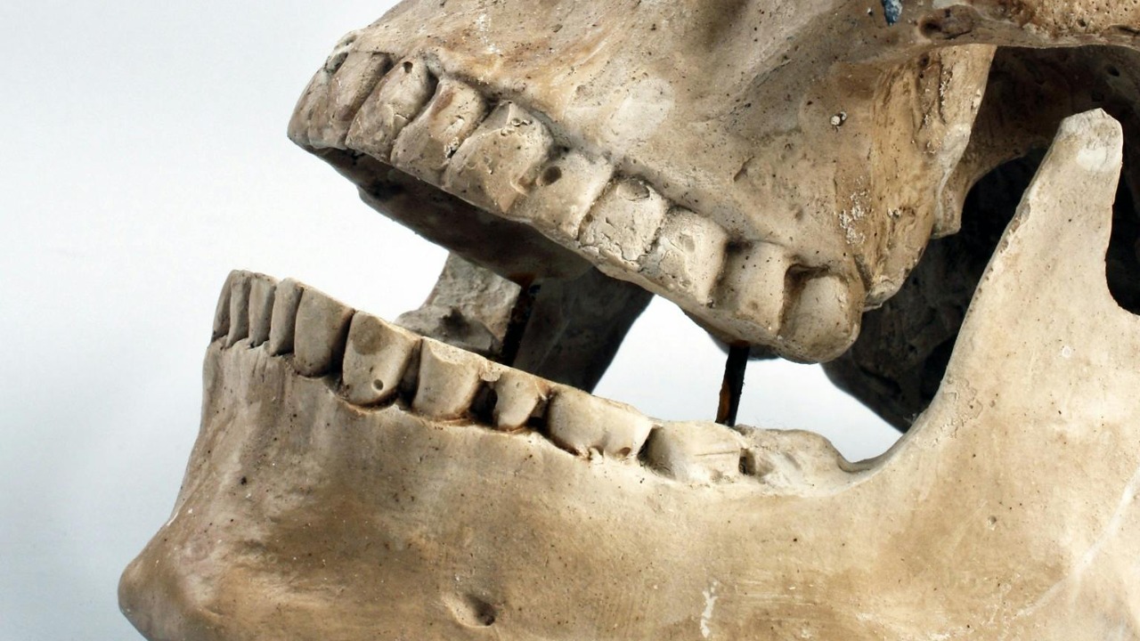 Why don’t teeth count as bones?