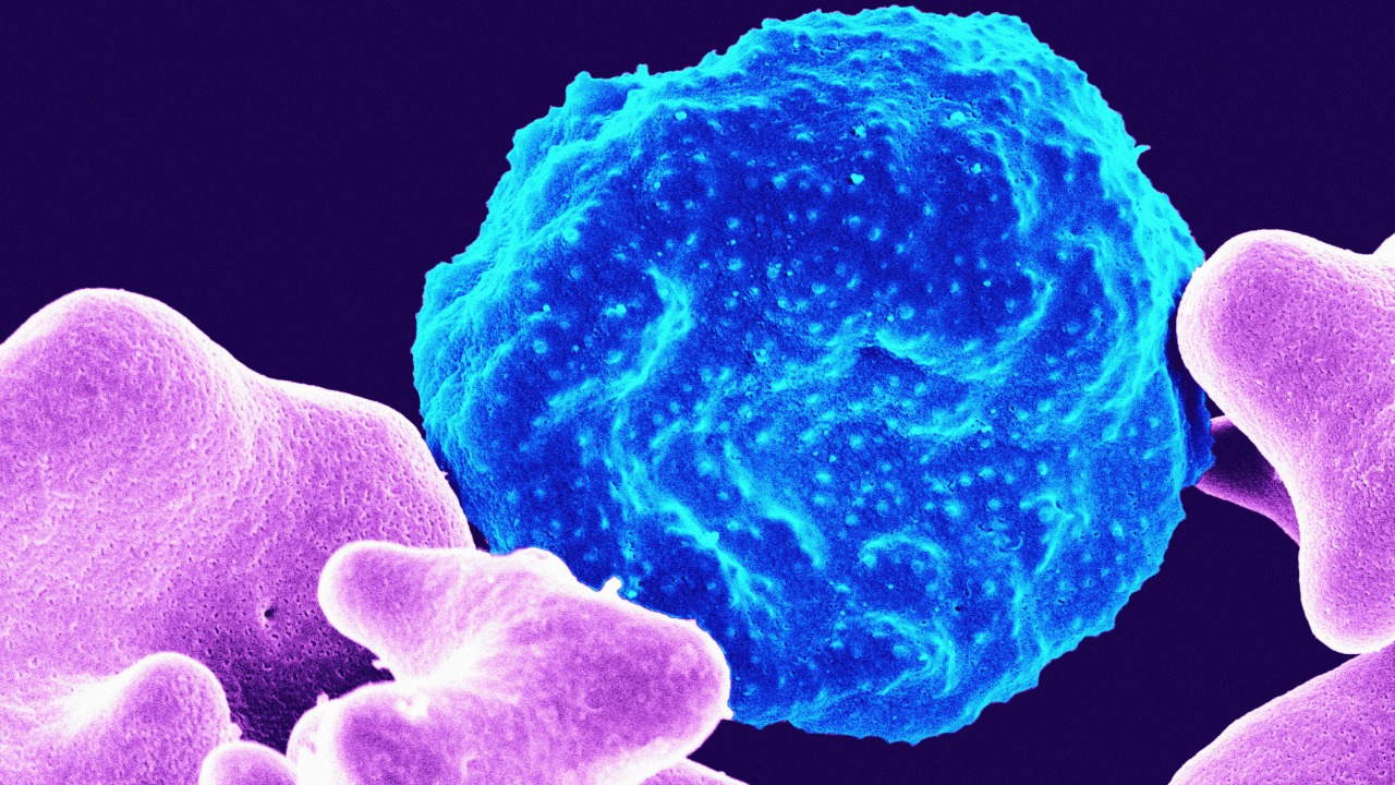 AI finds cancer cell clue doctors missed for years