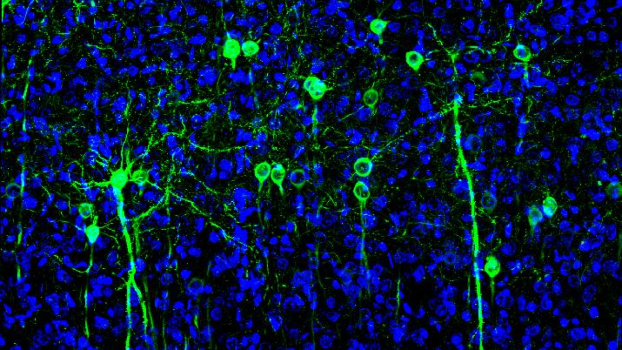 Scientists find 2 different cold sensors hiding in the body
