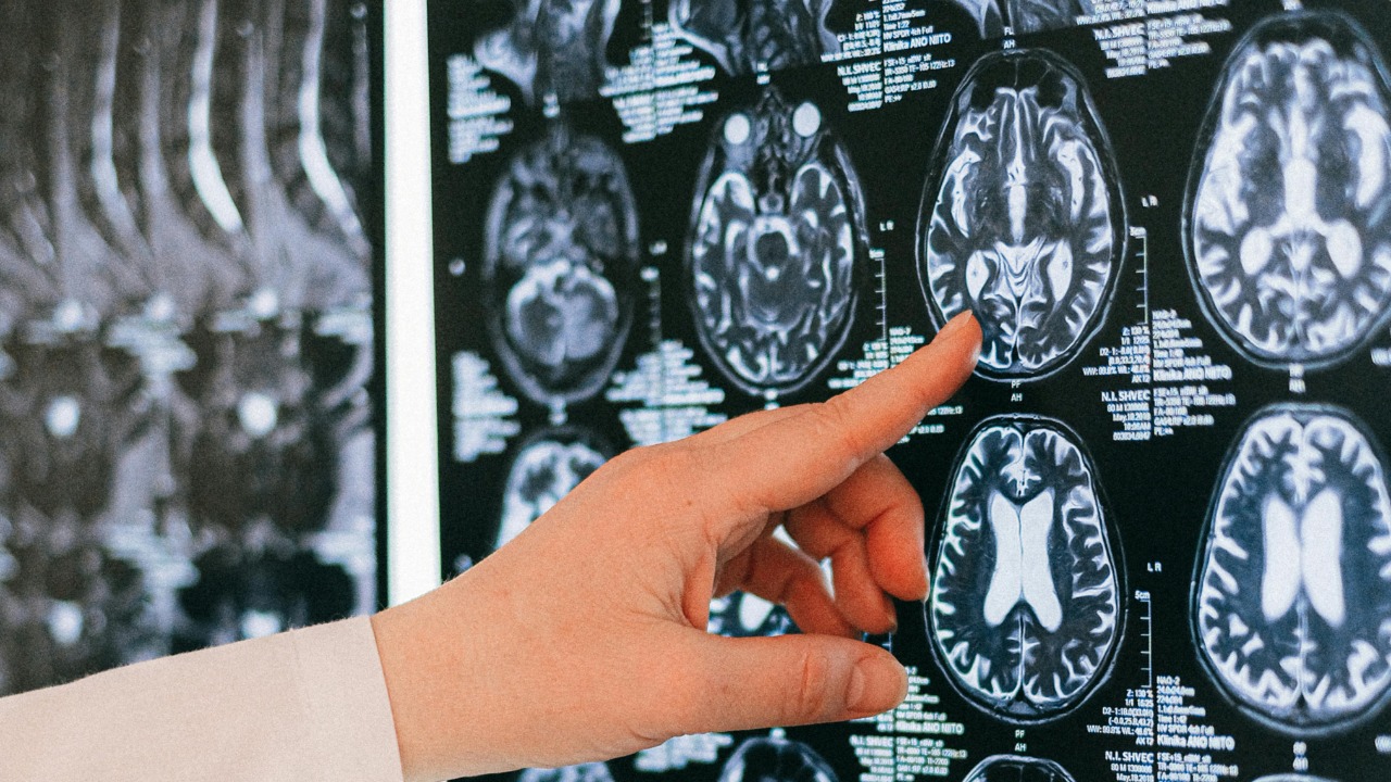 Scientists find why some brains stop growing too early