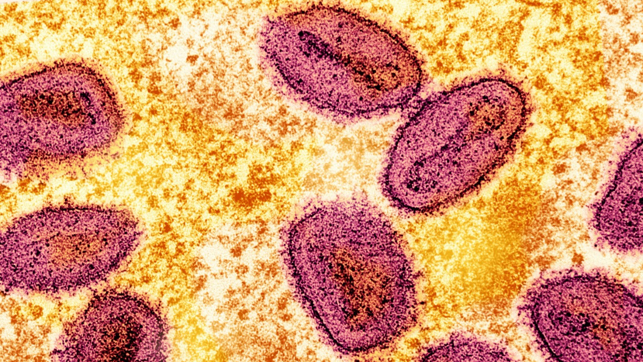 AI spots a monkeypox weak point that could remake vaccines