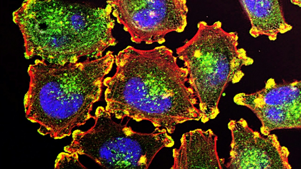 New antibody stops one of the deadliest breast cancers