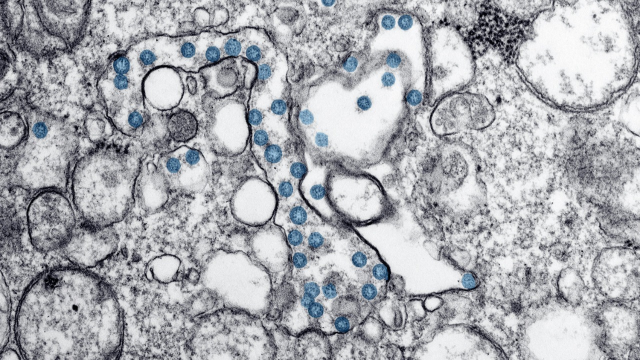 A virus frozen for 20,000 years was revived, and it raises questions