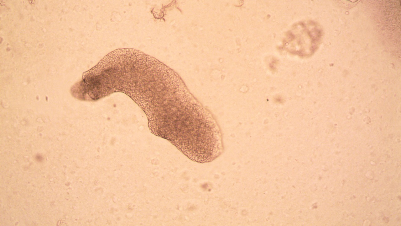 This heat-loving amoeba just shattered the complex life heat record