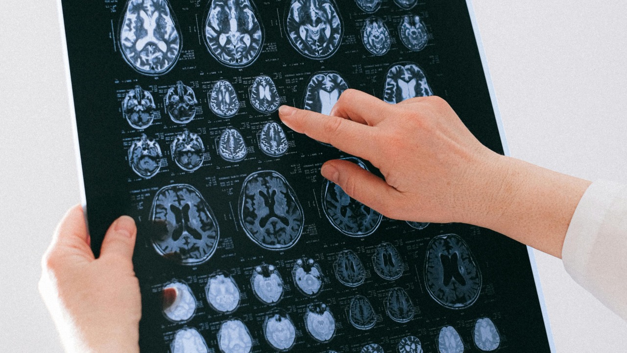 Scientists found a hidden appetite control switch in the brain