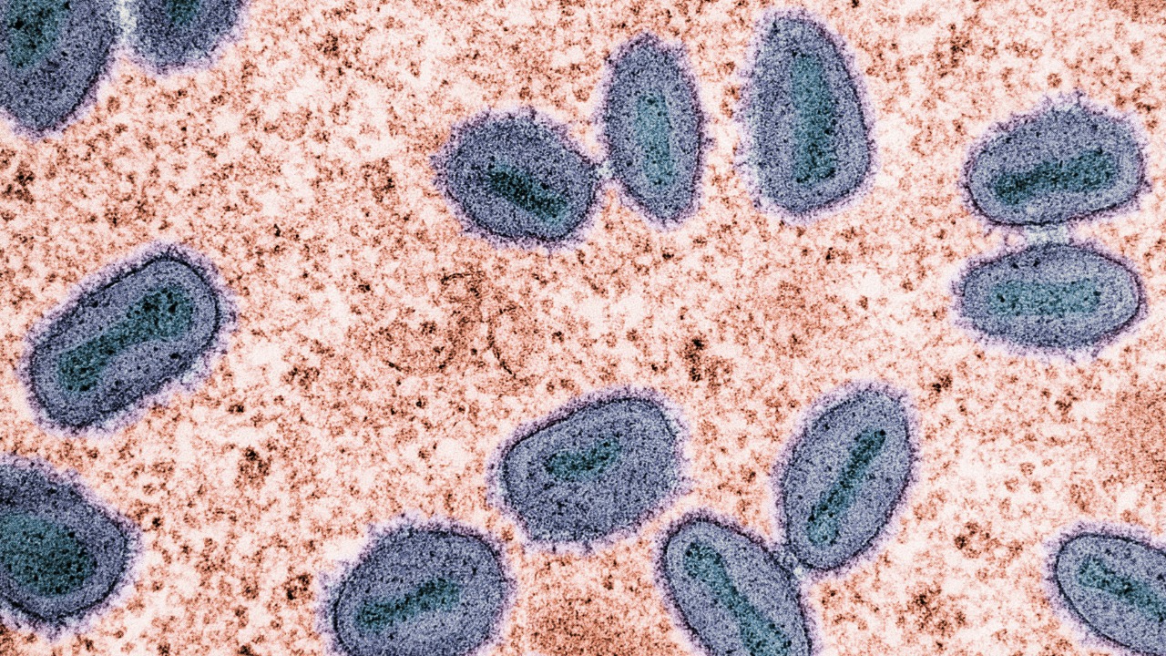 This giant microbe packs its DNA in a shocking pattern